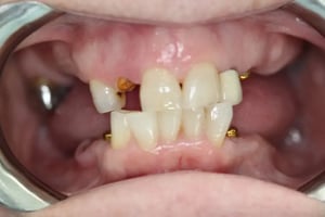 3-2-1024x683
