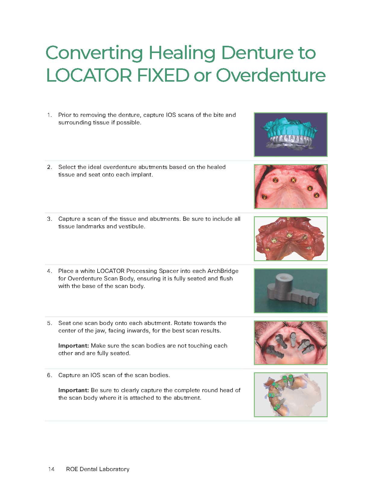 ArchBridge for Overdenture Workflows - Convert Existing Healing Dent_Page_1 ArchBridge for Overdenture Workflows - Convert Existing Healing Dent_Page_1