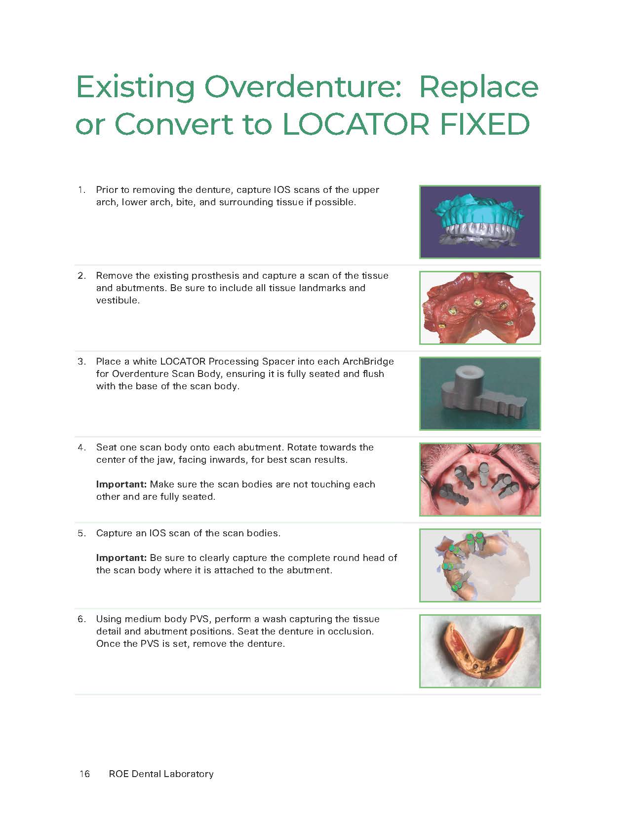 ArchBridge for Overdenture Workflows - Convert to LOCATOR FIXED_Page_1 ArchBridge for Overdenture Workflows - Convert to LOCATOR FIXED_Page_1