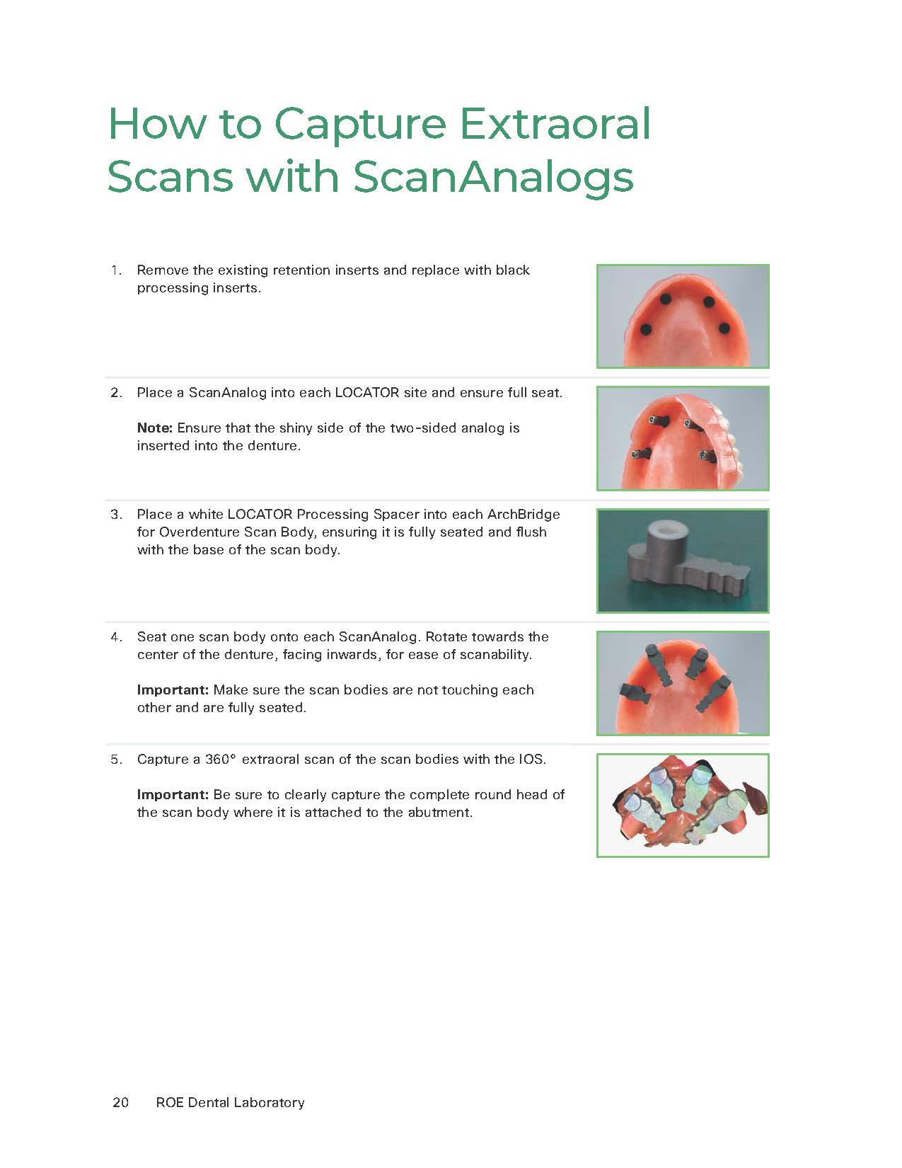 ArchBridge for Overdenture Workflows - Extraoral ScanAnalogs ArchBridge for Overdenture Workflows - Extraoral ScanAnalogs