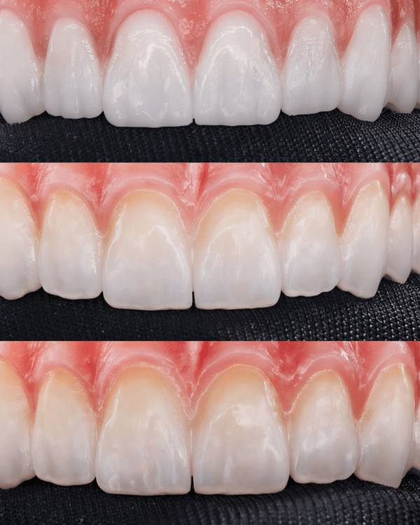 Bespoke Shade Differences