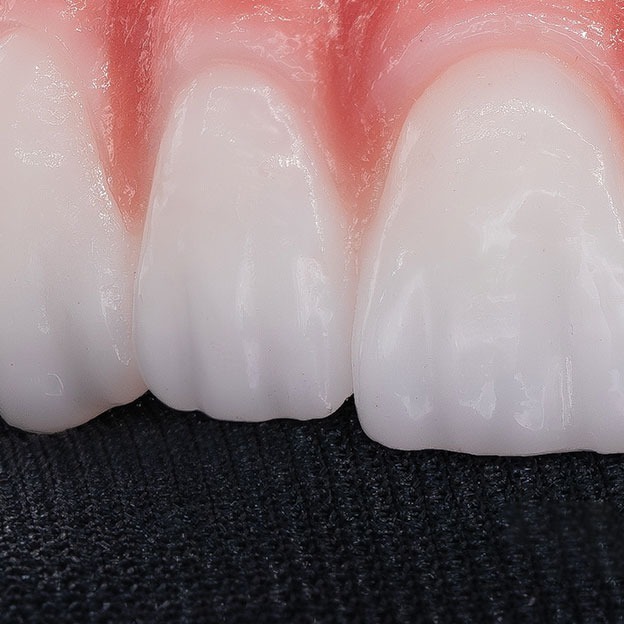 imgi_98_pronounced-tooth-texture