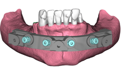 Fixation Base Model