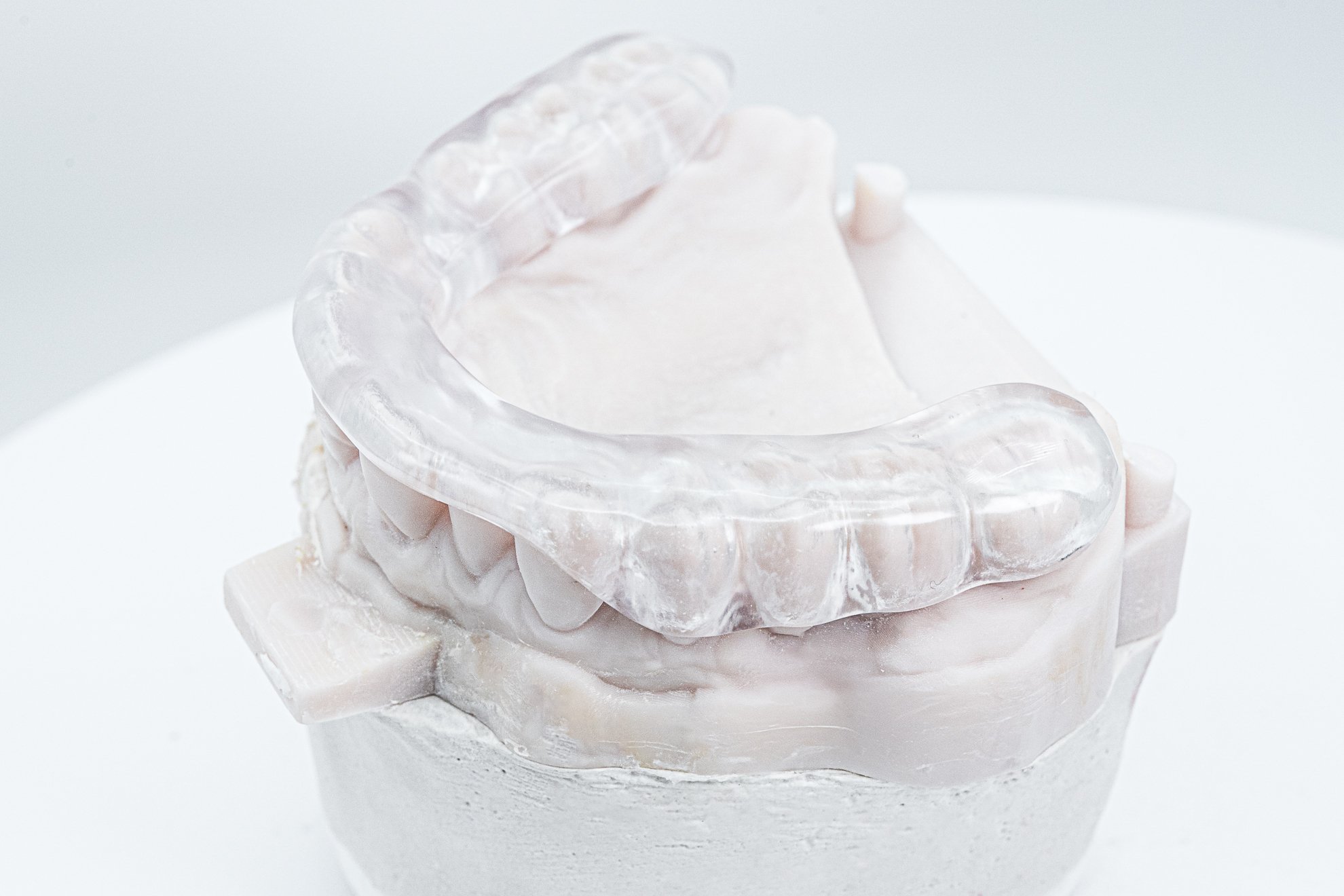 CLEARsplint Gallery (1)