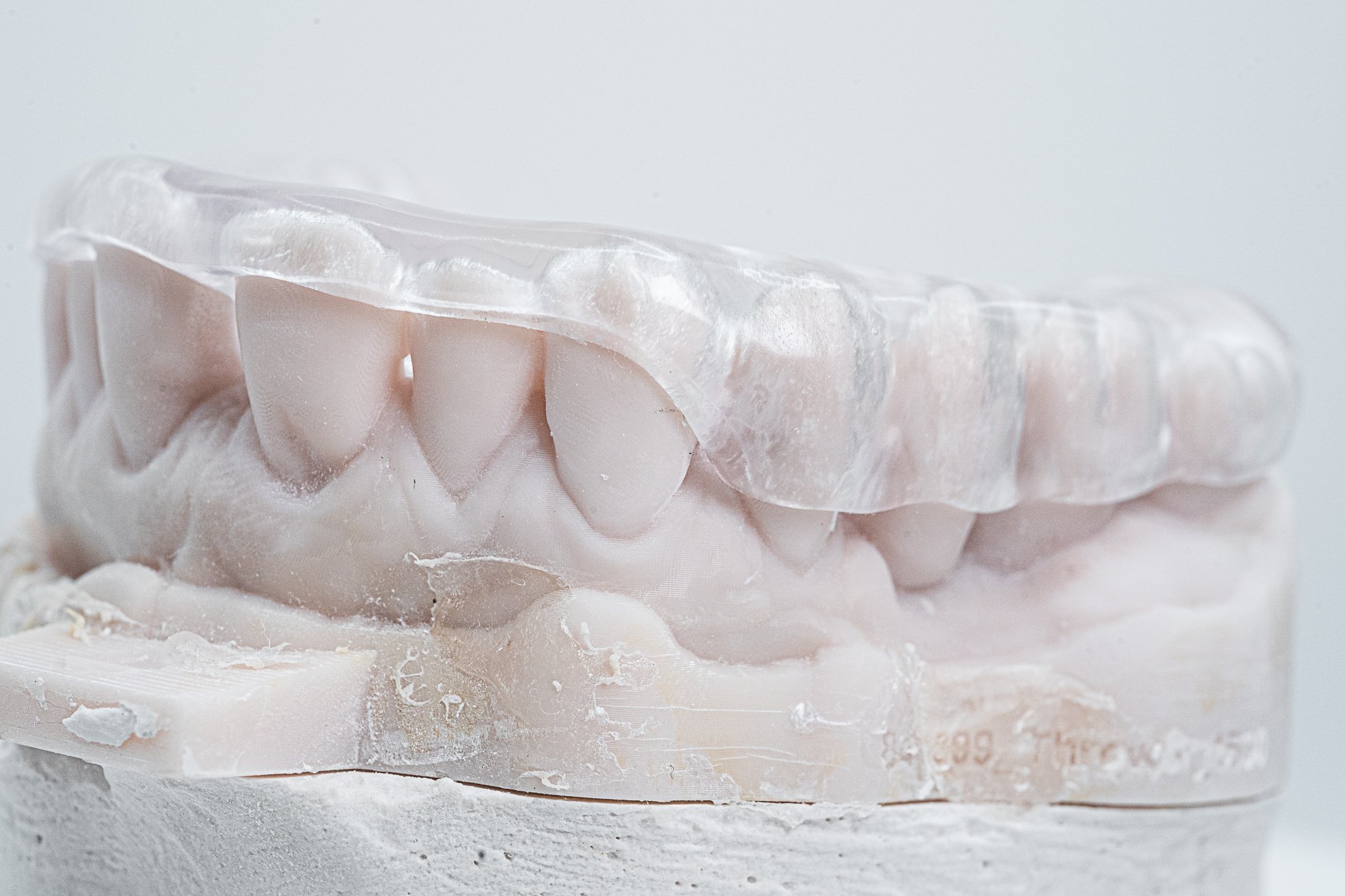 CLEARsplint Gallery (2)