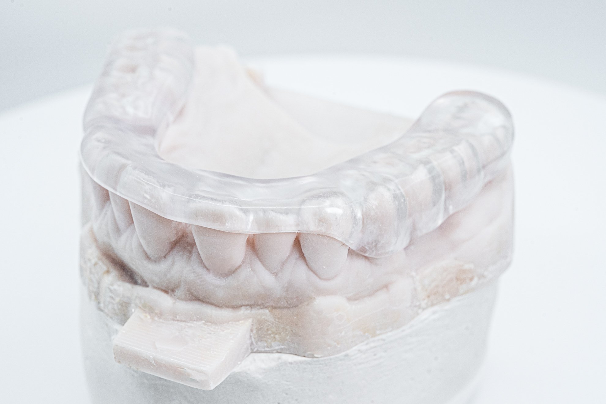 CLEARsplint Gallery (3)
