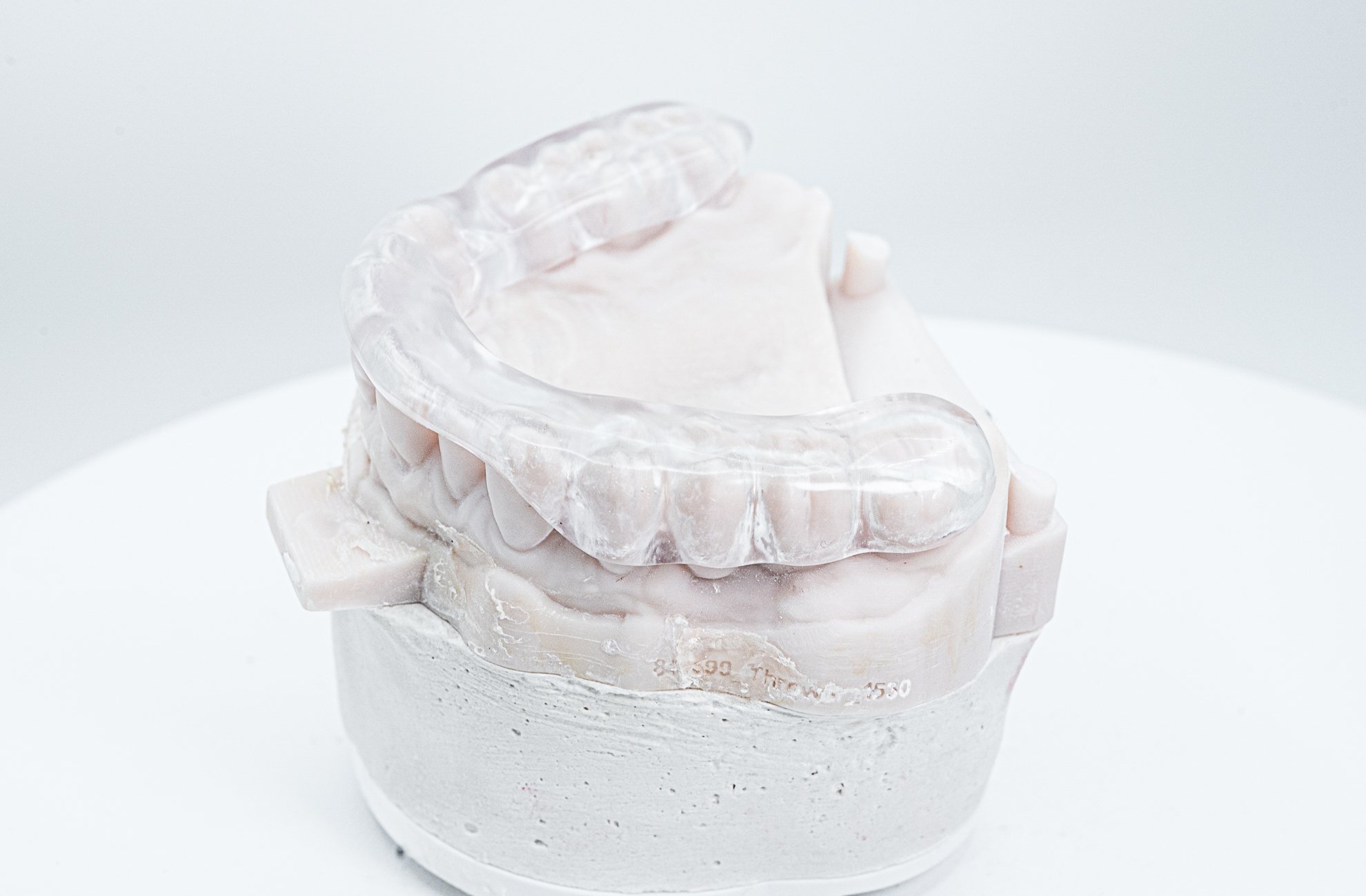 CLEARsplint Gallery (5)