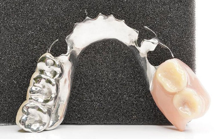 CoCr-Partial-Denture