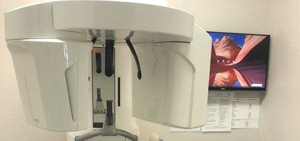 cbct