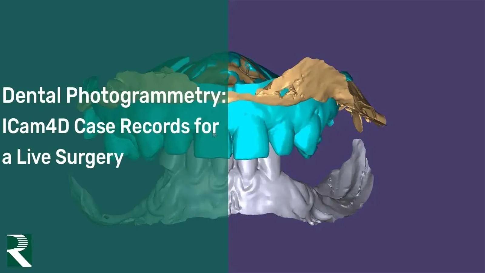 Dental-Photogrammetry-ICam4D-Case-Records-for-a-Live-Surgery