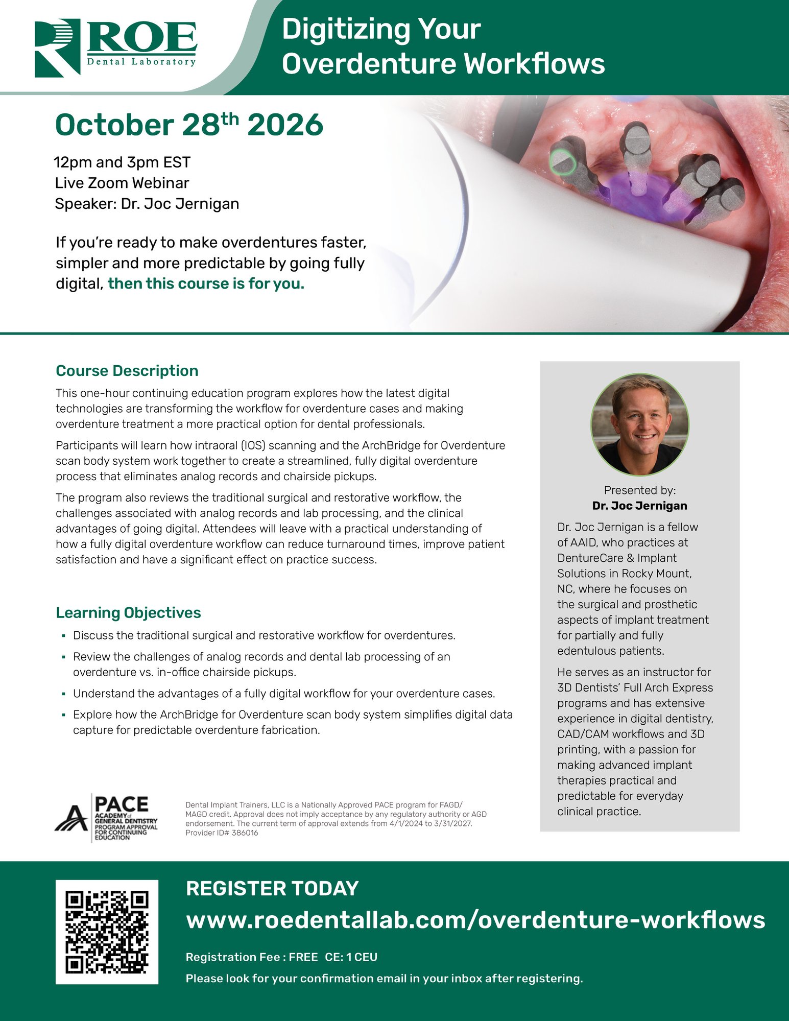 Digitizing your Overdenture Workflows Digitizing your Overdenture Workflows