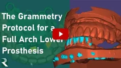 Grammetry-and-the-CombiGuide-Protocol-for-a-Full-Arch-Lower-Prosthesis-400x225