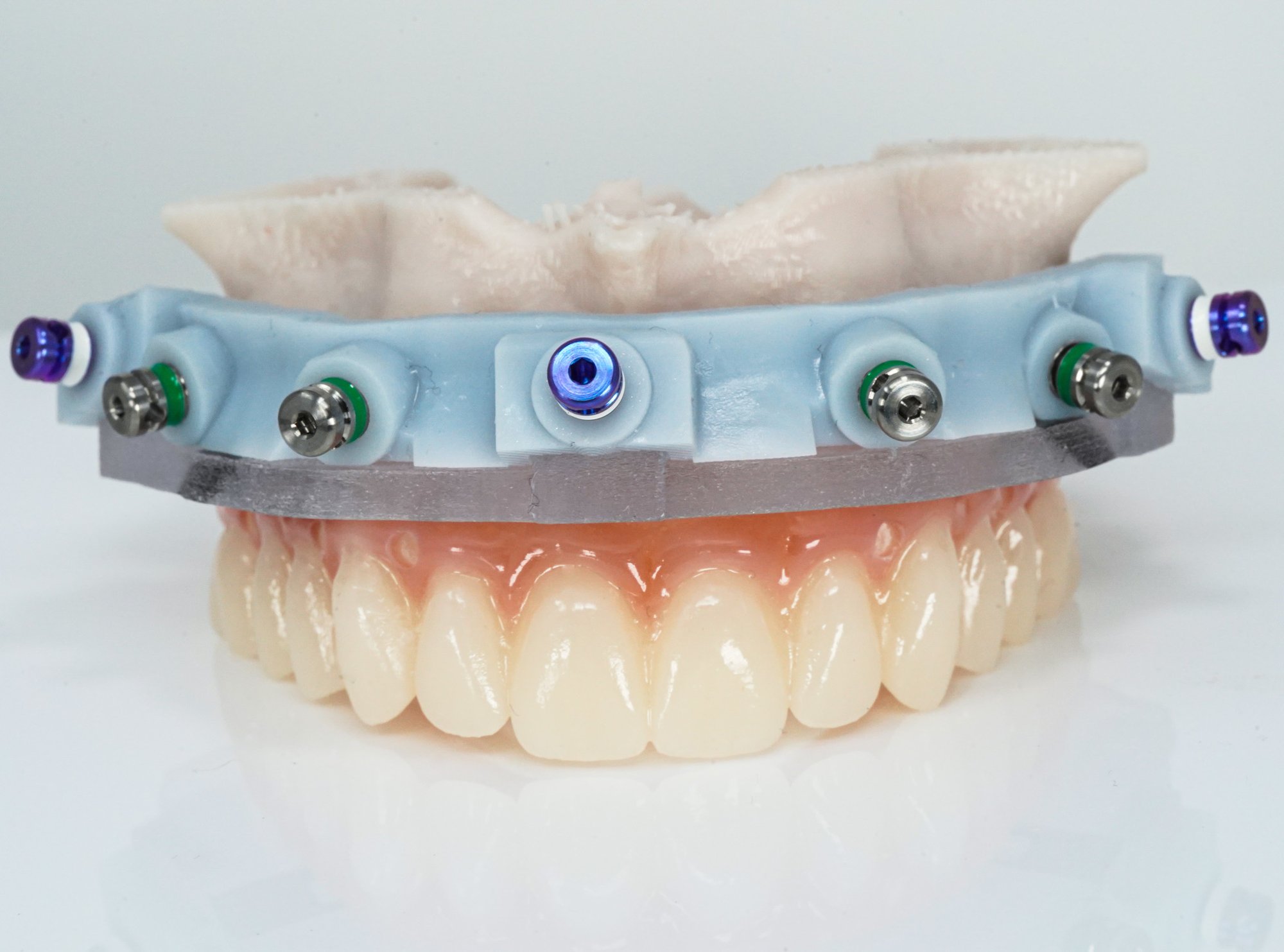 GuidedSMILE Lite (2)