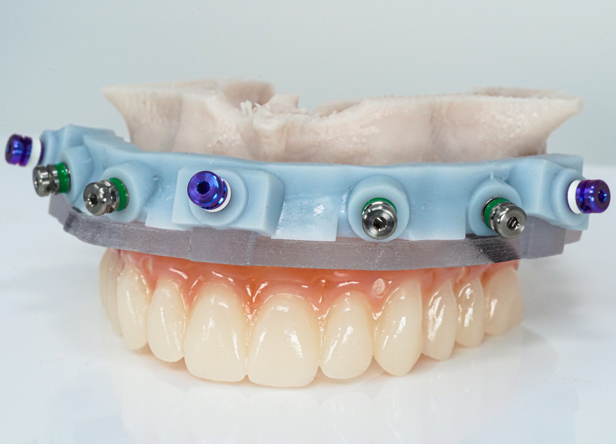GuidedSMILE Lite (3)
