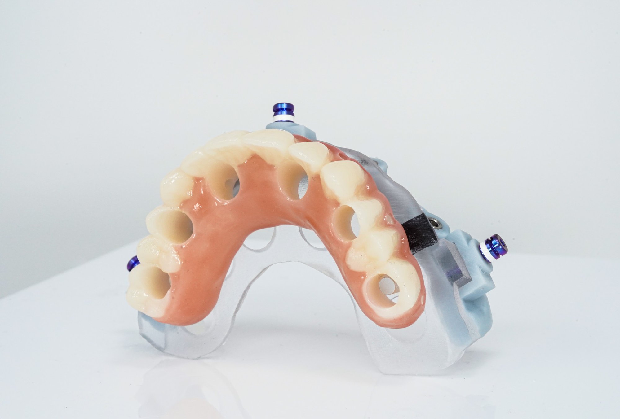 GuidedSMILE Lite (4)