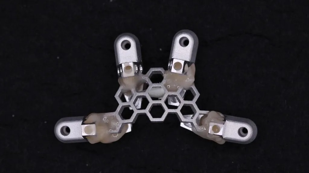 OptiSplint-Luted-1024x575