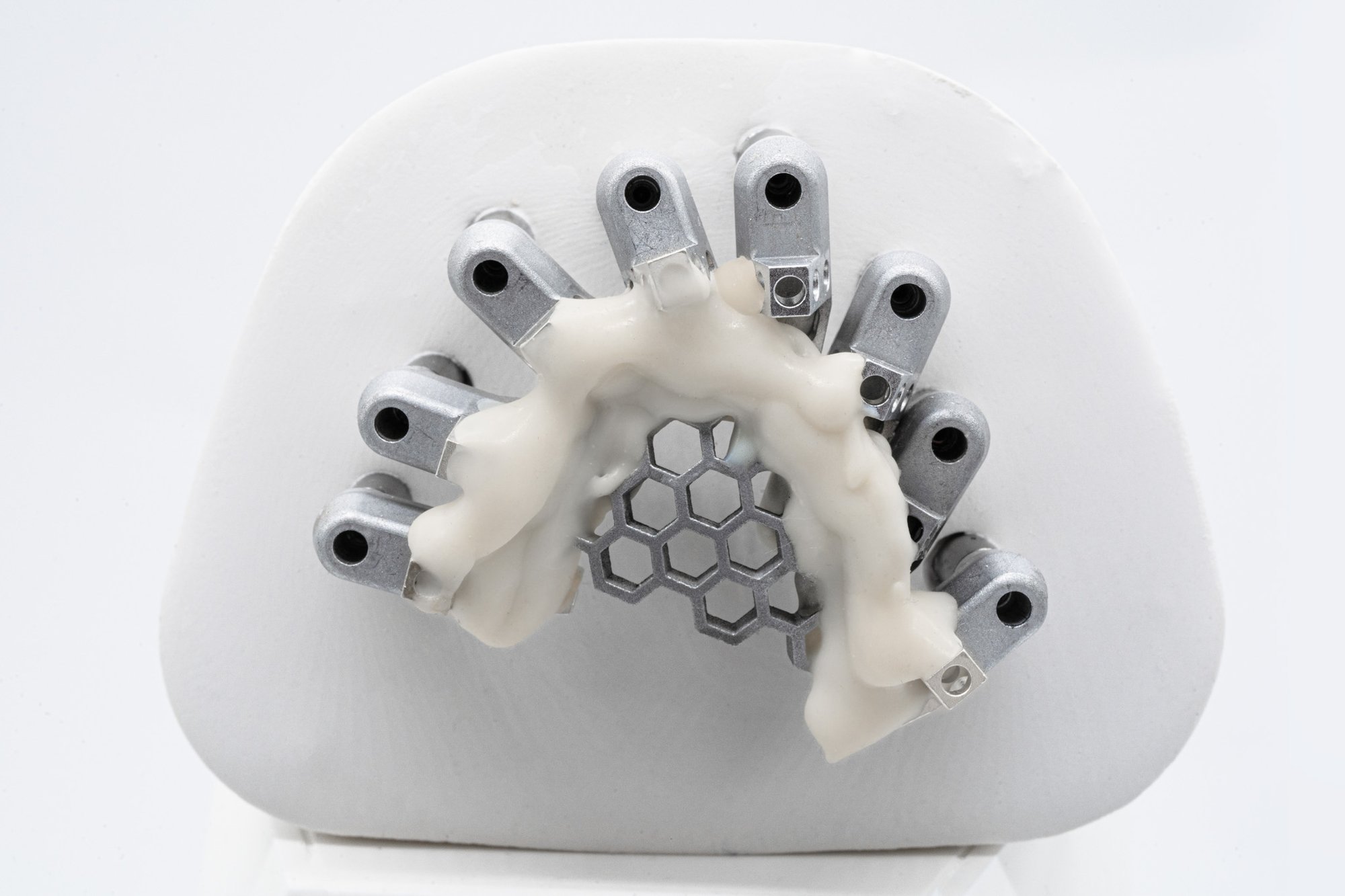Optisplint Gallery (5)