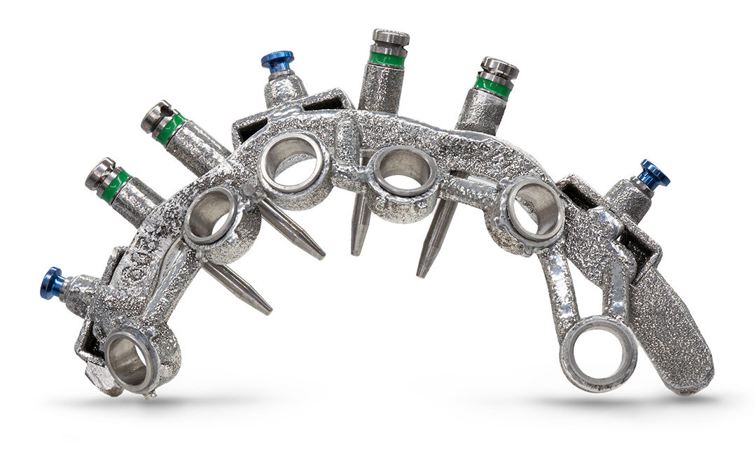 GuidedSMILE CombiGuide osteotomy guide component