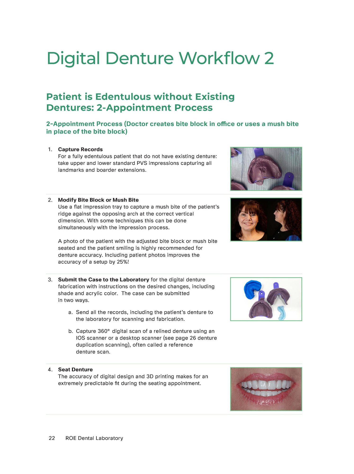 Workflow_360_Digital Denture Workflow 2