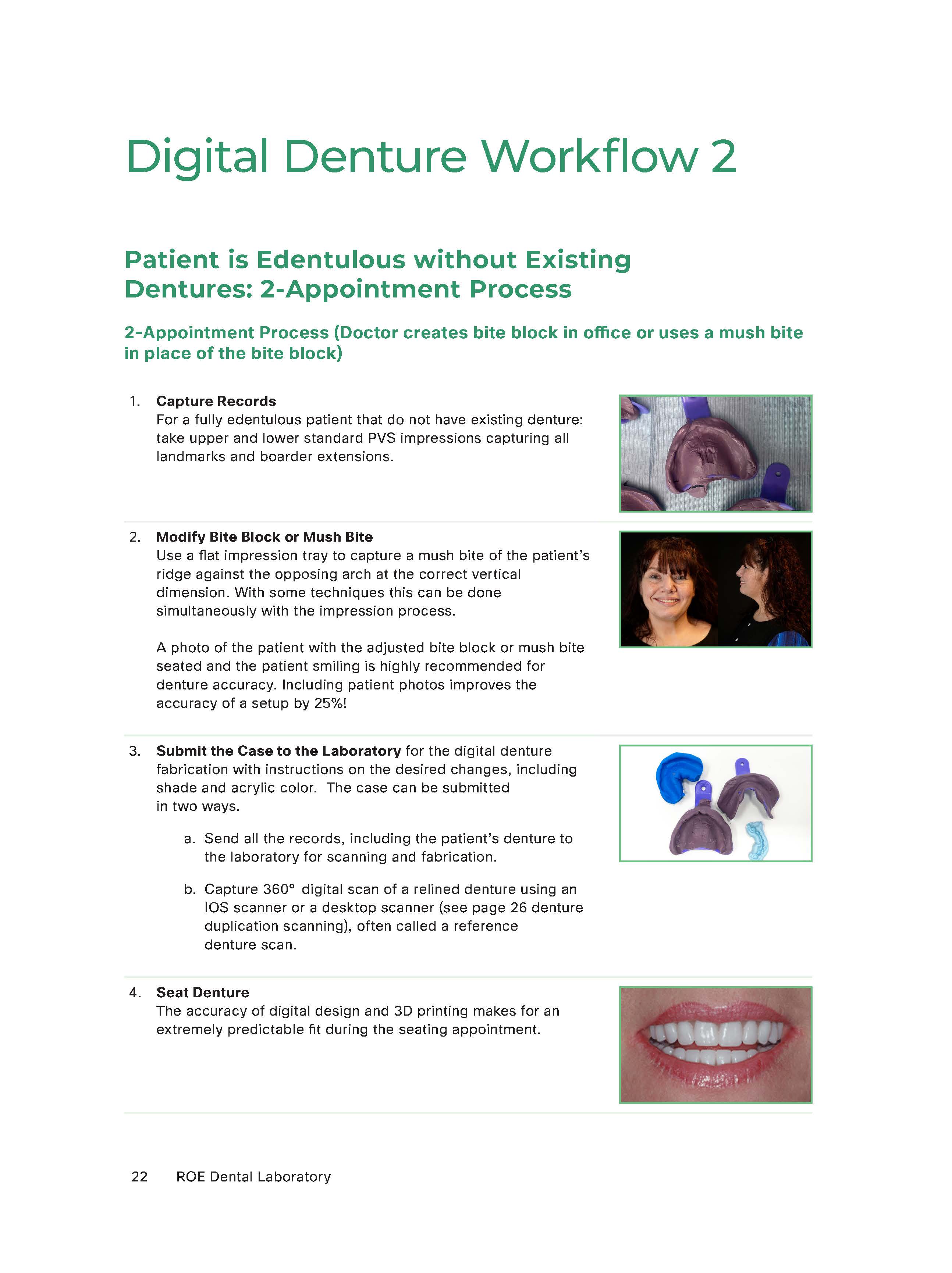Ivotion Digital Denture - the Strongest Digital Denture on the market