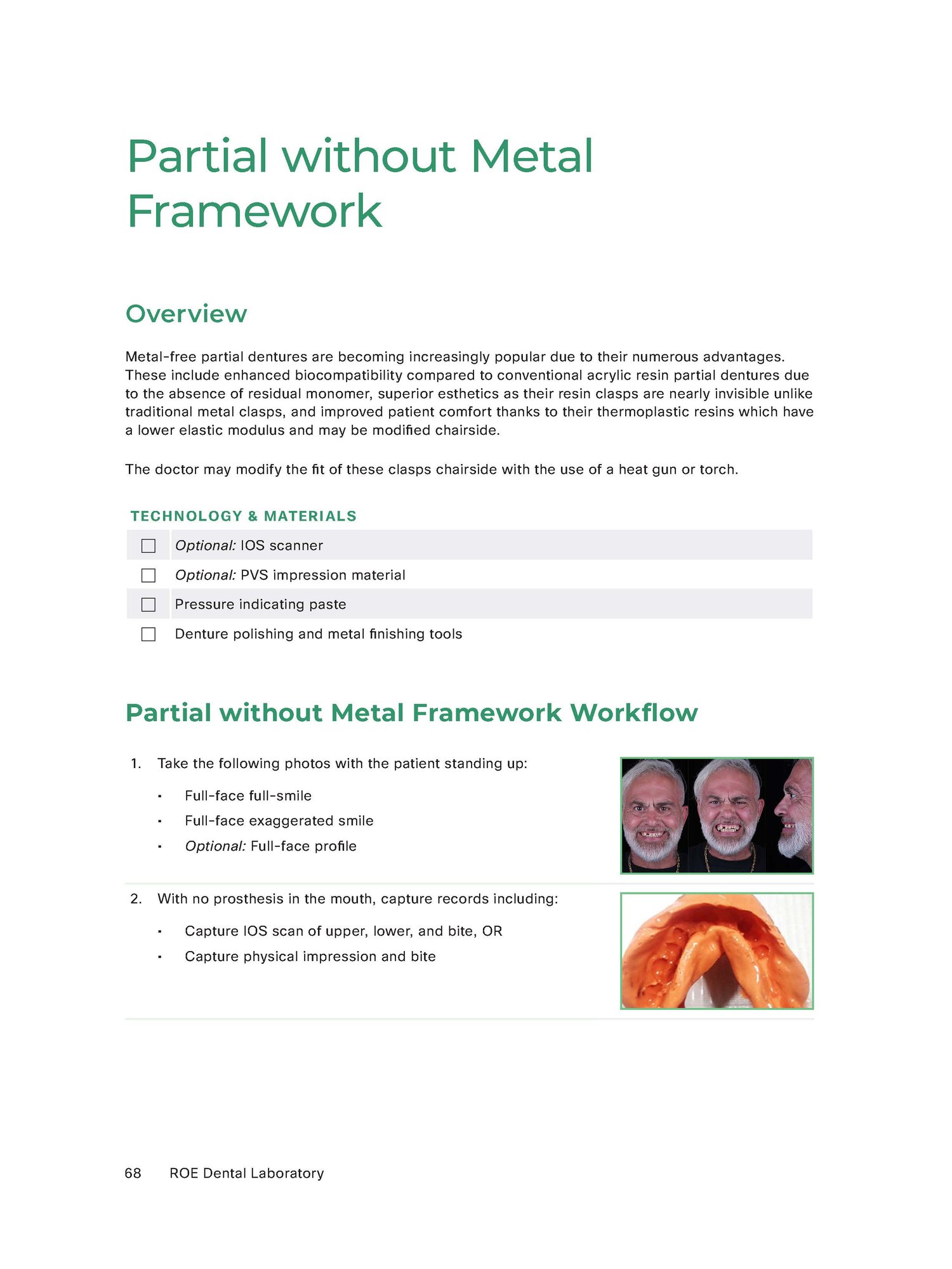 Workflow_Removable_Partial without Metal Framework_Page