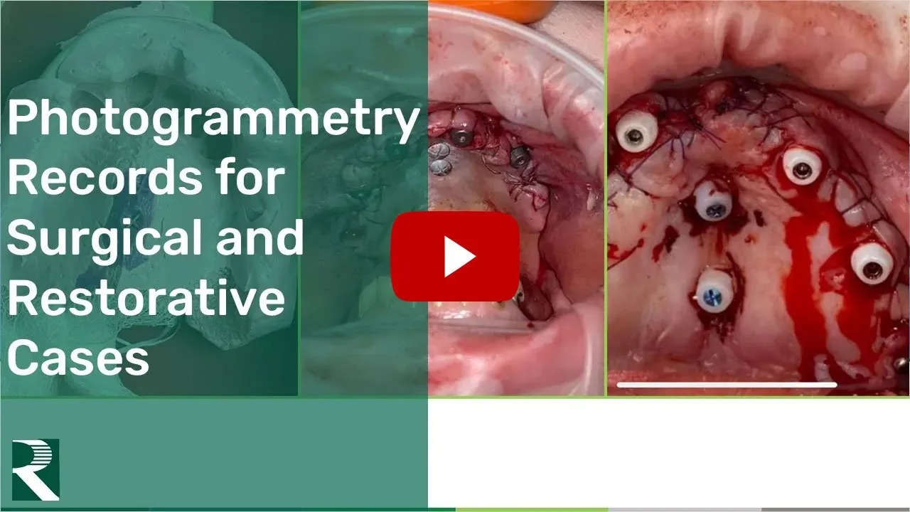 Photogrammetry-Records-for-Surgical-and-Restorative-Cases