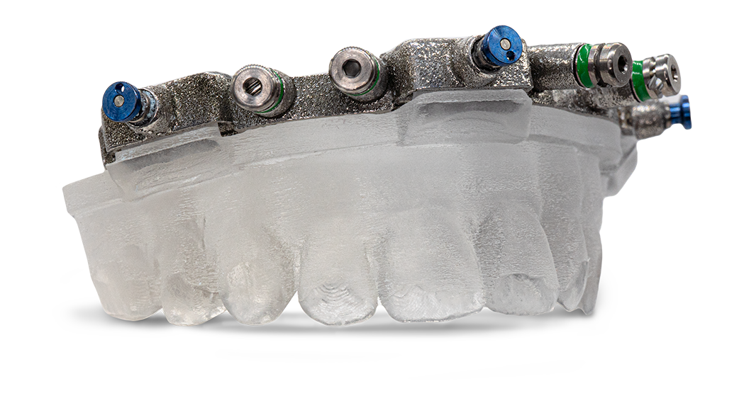GuidedSMILE CombiGuide pin guide and fixation base components