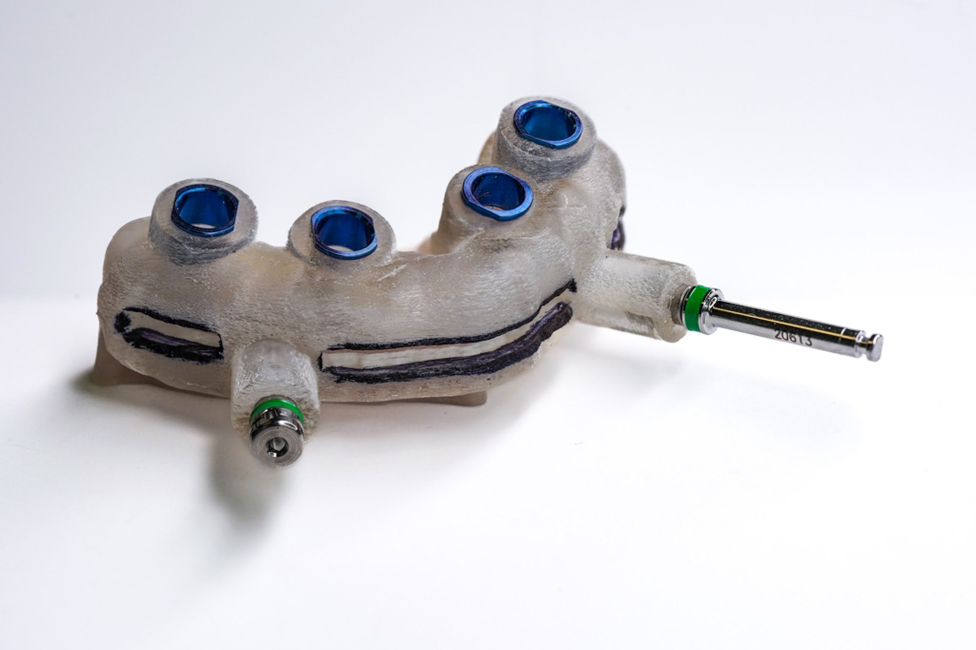 Edentulous-Bone-Channel-Surgical-Guide-03