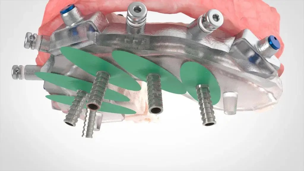 Gaskets