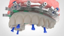 RAPID-Plugs