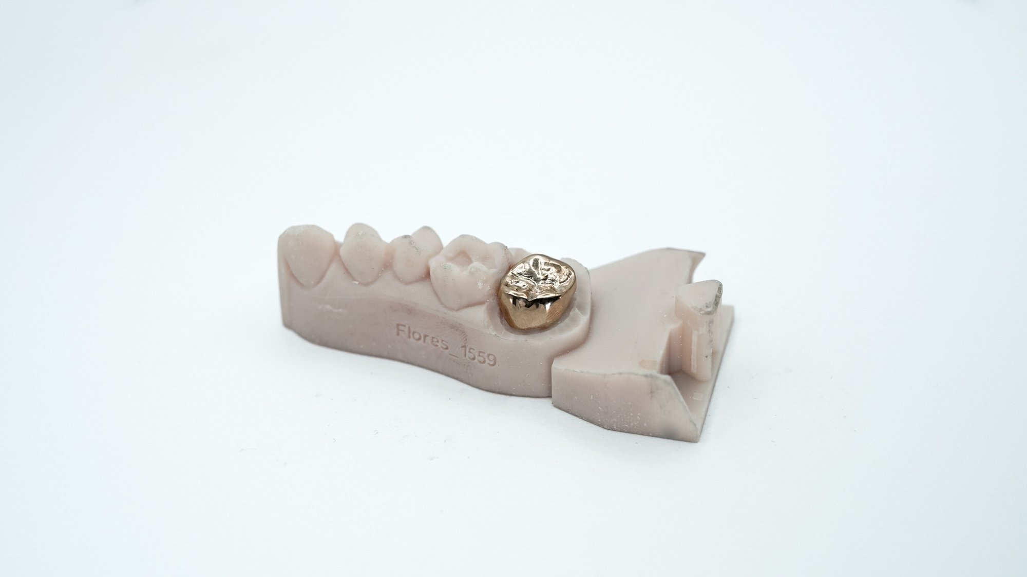 MetalCrown_5