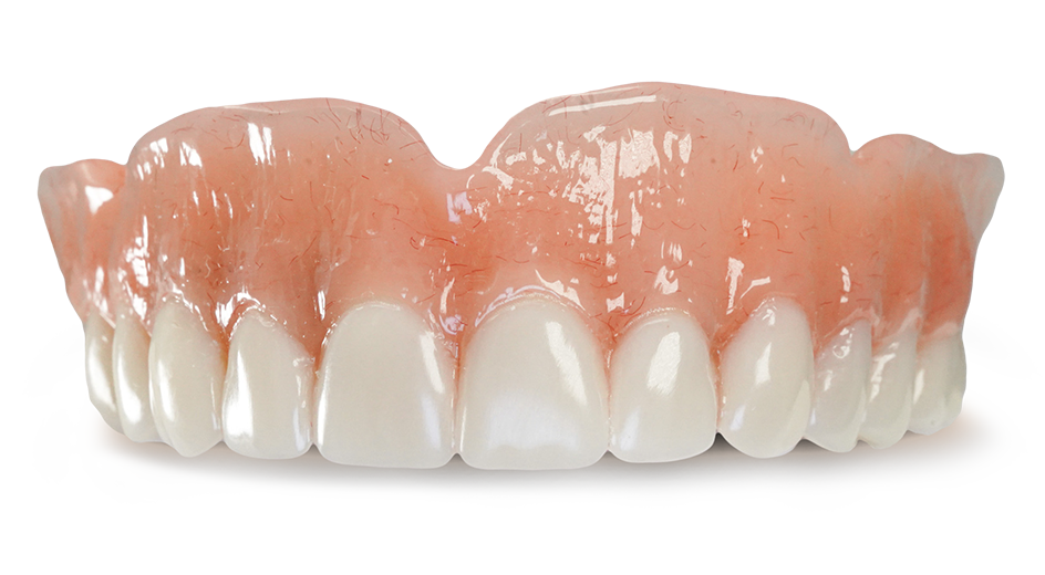 Locator Overdenture Hero