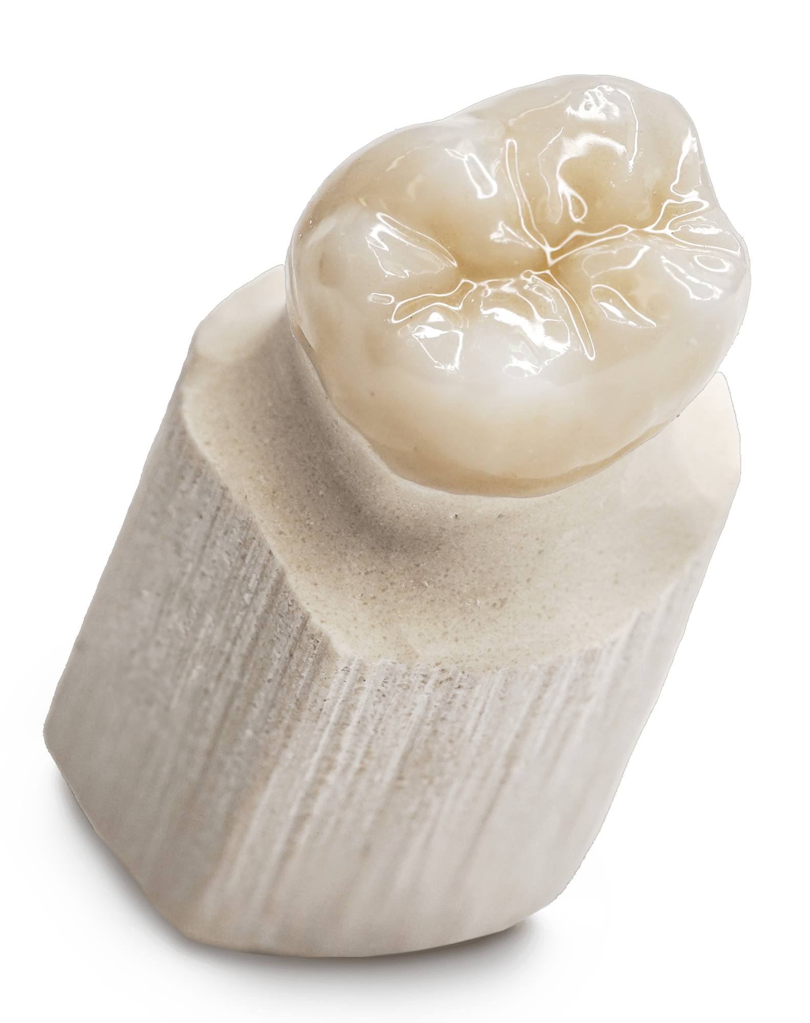 TLZ Zirconia Crown Overview