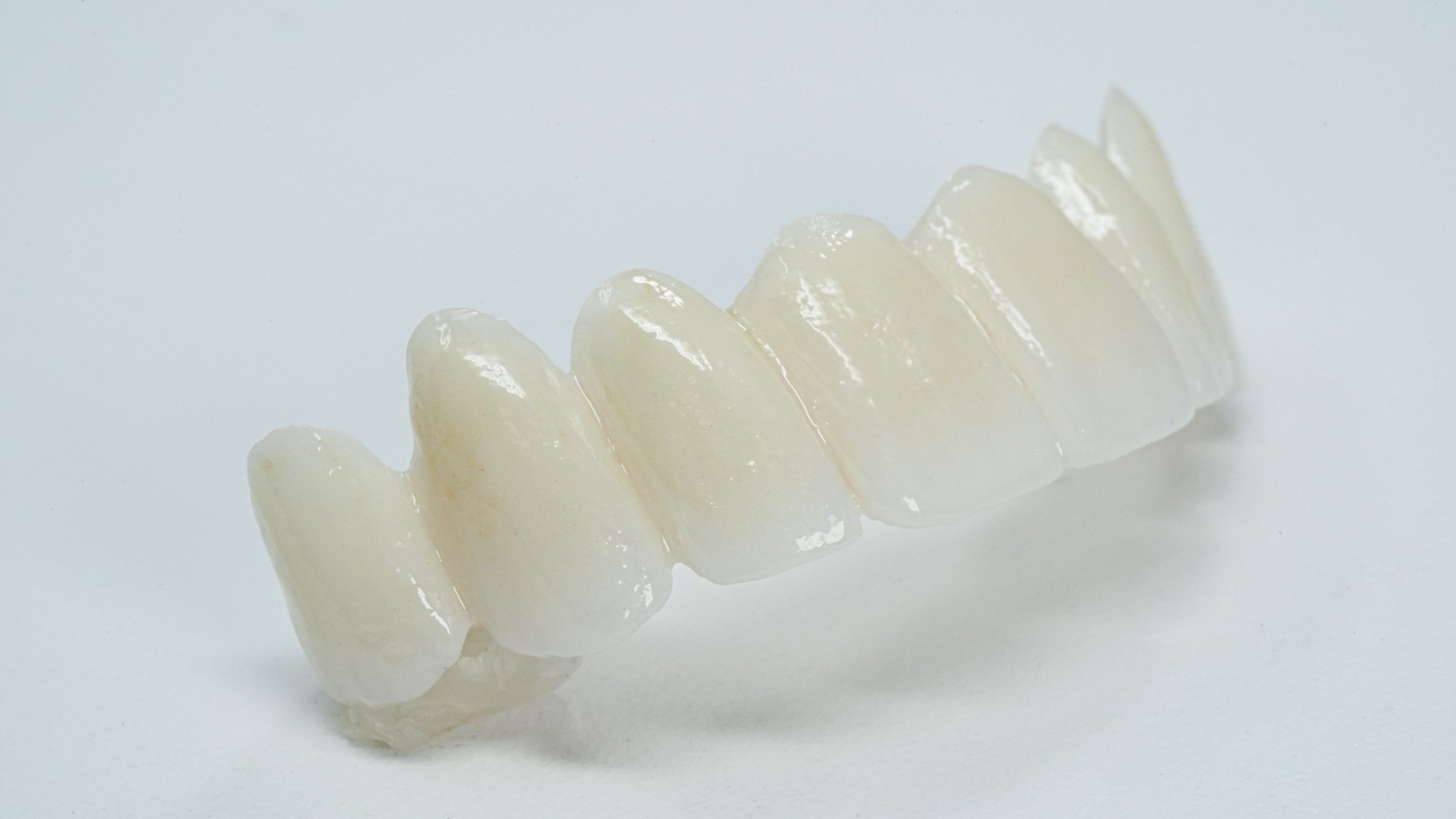 PFZ (Porcelain Fused Zirconia)