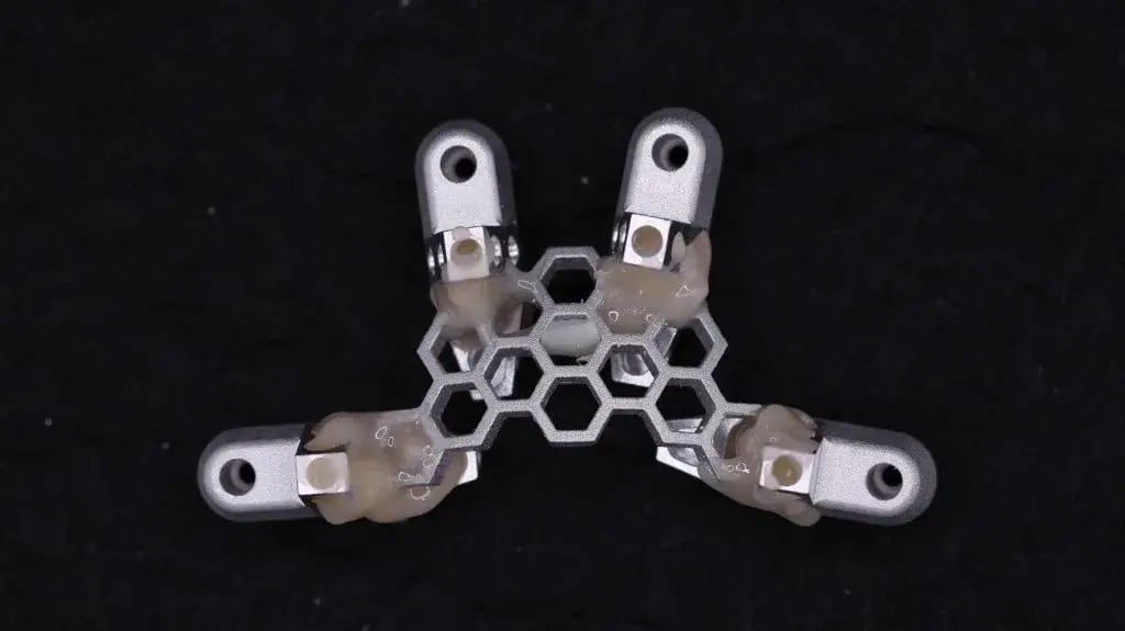 OptiSplint-Luted-1024x575