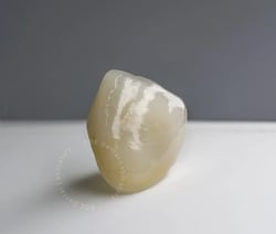 PFZ-eMax-Anterior-Crown
