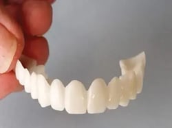 Snap-on-smile-sized