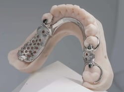 Traditional-Partial-Dentures-2-1024x762