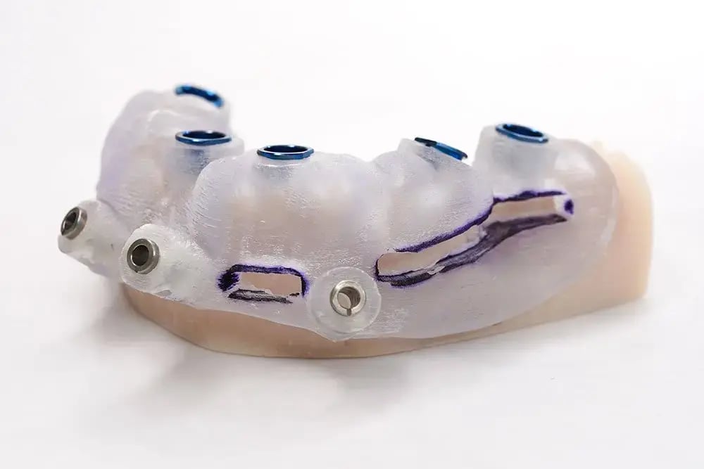 bone-supported