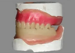 staub-cranial-denture-appointment-2