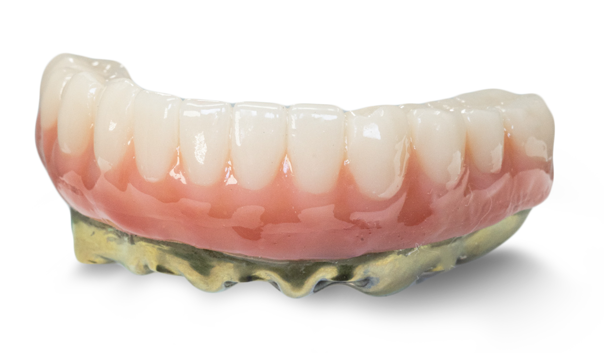 TLZ-IB Zirconia with Metal Full-Arch Hero