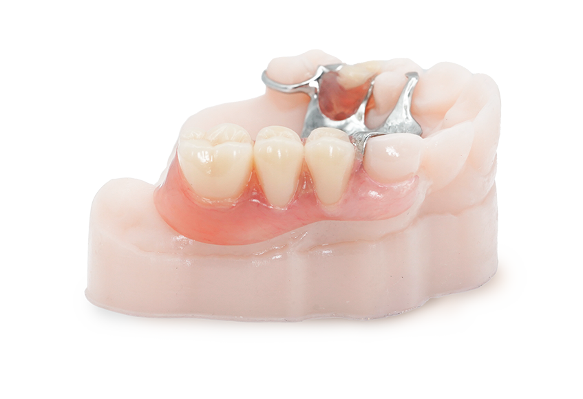Thermoplastic Partial Hybrid Overview
