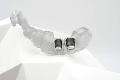 Tooth-Supported-Guide-Open-Channels