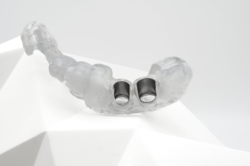 Tooth-Supported-Guide-Open-Channels