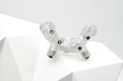 Tooth-Supported-Guide-Pilot-Anchor-Holes
