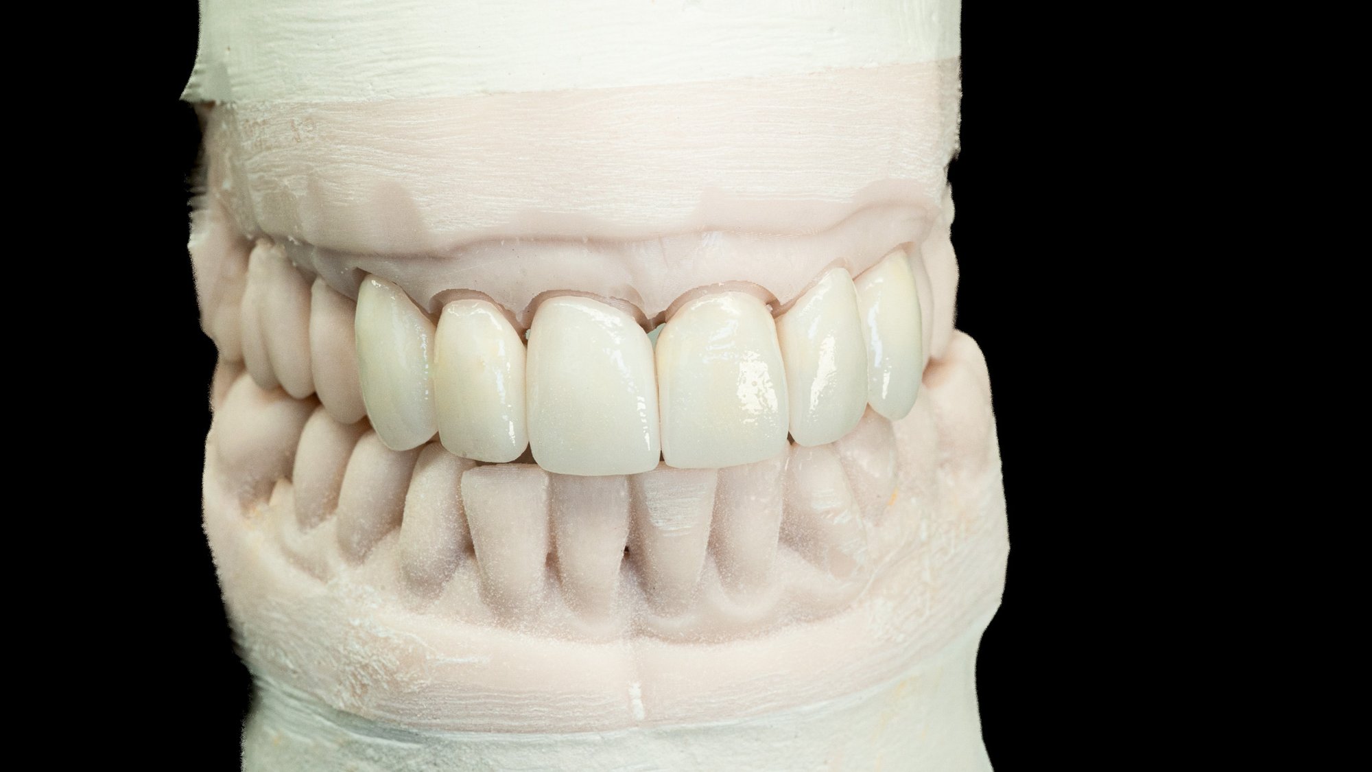 emax-layered-1