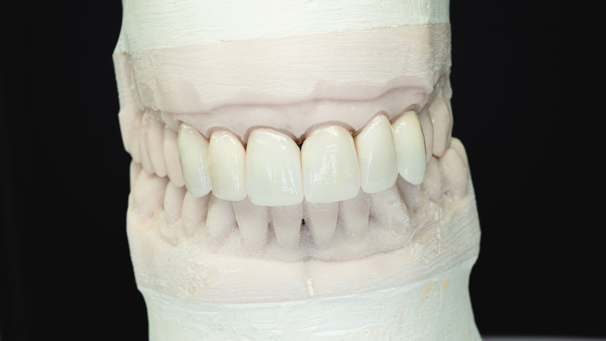 emax-layered-2