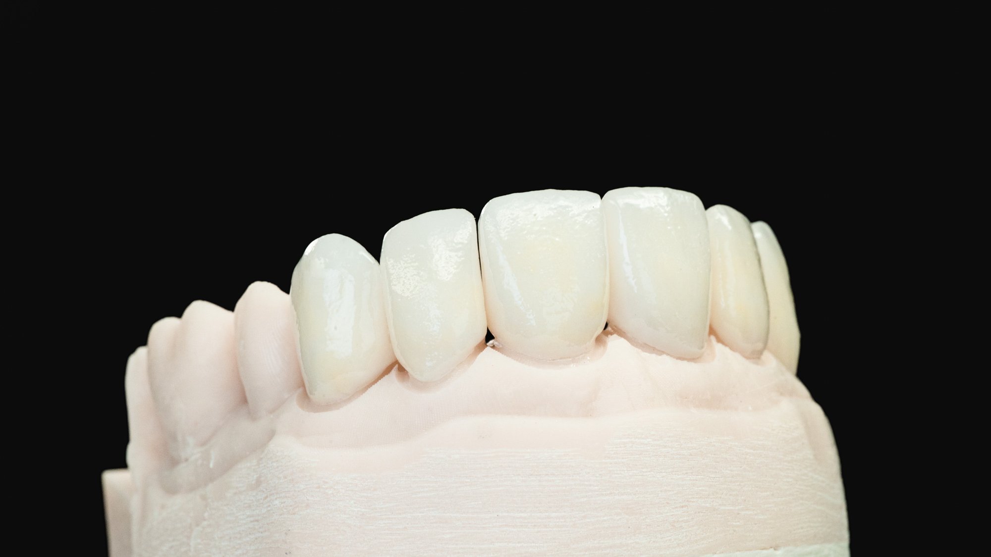 emax-layered-4