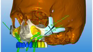 gs-zygo-4