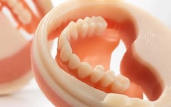 ivotion-milled-denture2